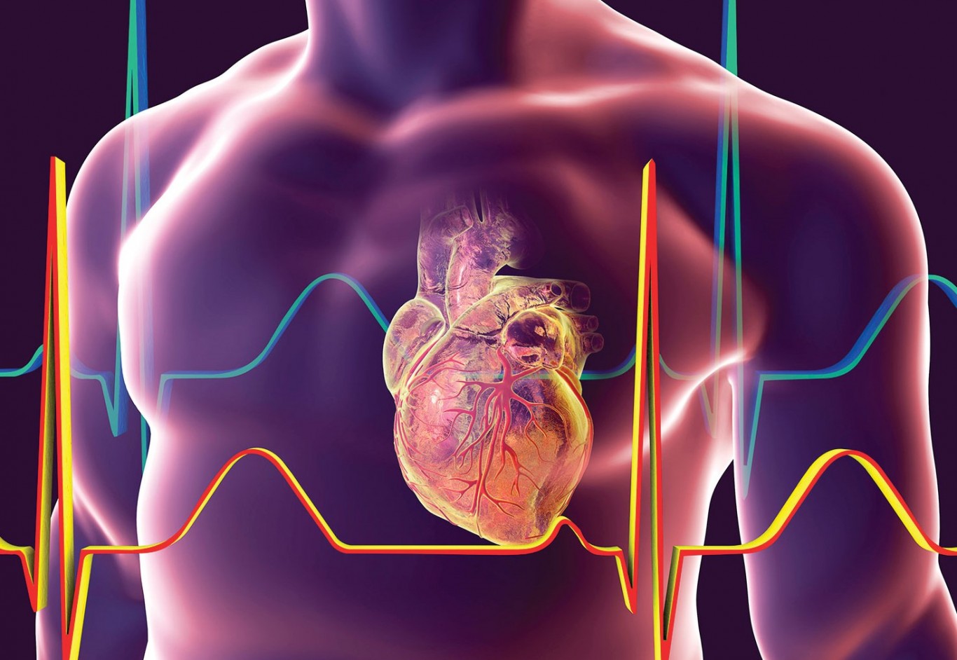 Home Cardiovascular Consultants of South